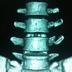3D CT Scan 2